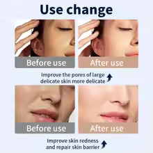 Máscara Facial LED Premium — Rejuvenece tu Piel con Tecnología Profesional